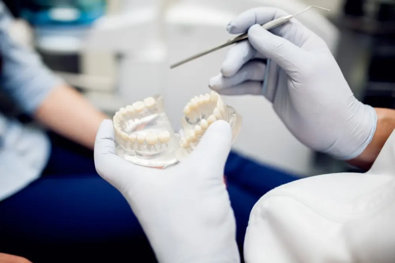 Hoe worden Tandheelkundige Kronen toegepast en in welke gevallen hebben ze de voorkeur? 