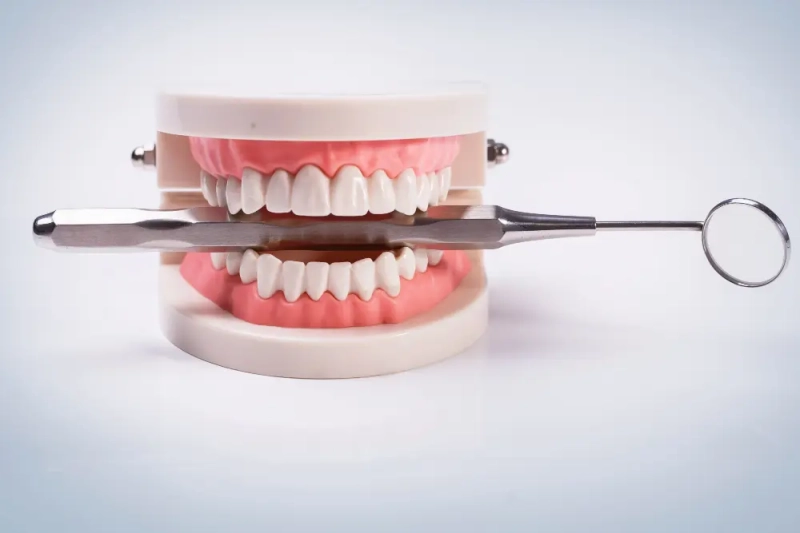 Wat zijn tandheelkundige implantaten en hoe worden ze toegepast? 